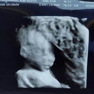 Meet your Posher, Alba